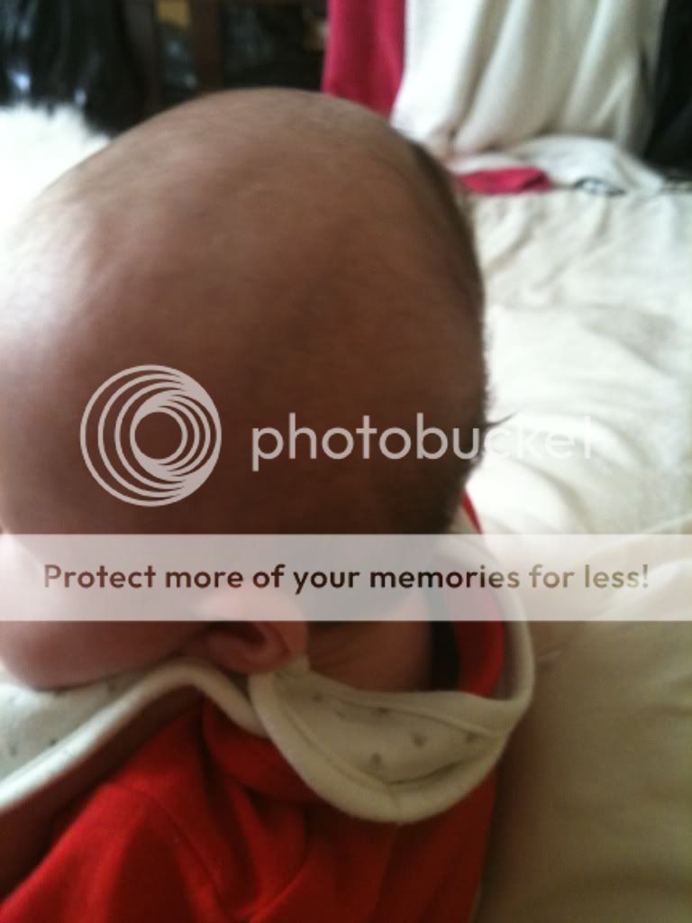 Would you helmet? - BabyCenter